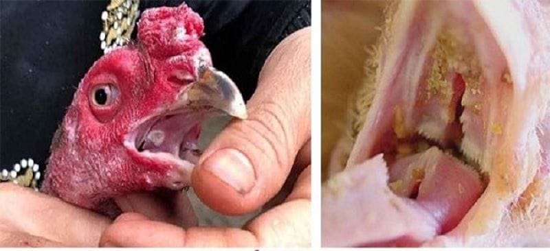 Có thể áp dụng các bài thuốc dân gian để chữa trị 